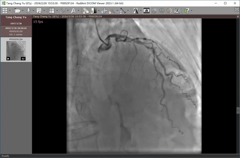 心脏造影视频播放器 | RadiAnt DICOM Viewer / Dicom Viewer（v2025.1 / v3.0.28.1210）-软件工具箱