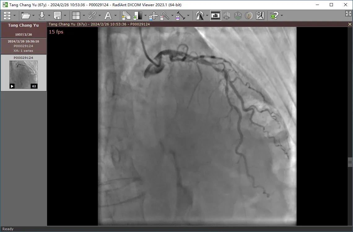 图片[1]-心脏造影视频播放器 | RadiAnt DICOM Viewer / Dicom Viewer（v2025.1 / v3.0.28.1210）-软件工具箱